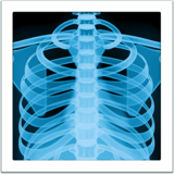 Radiographie Emoji U+1FA7B